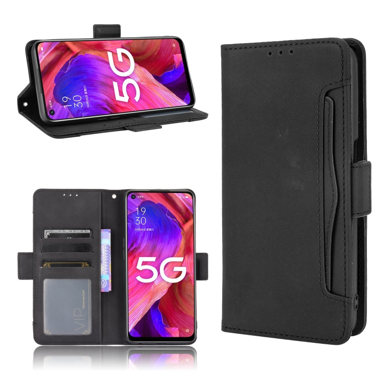 Skin Feel Calf Pattern Horizontal Flip Leather Case with Holder & Card Slots & Photo Frame