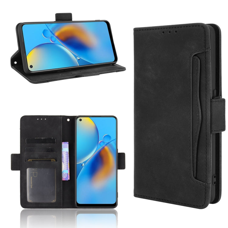 Skin Feel Calf Pattern Horizontal Flip Leather Case with Holder & Card Slots & Photo Frame — Black