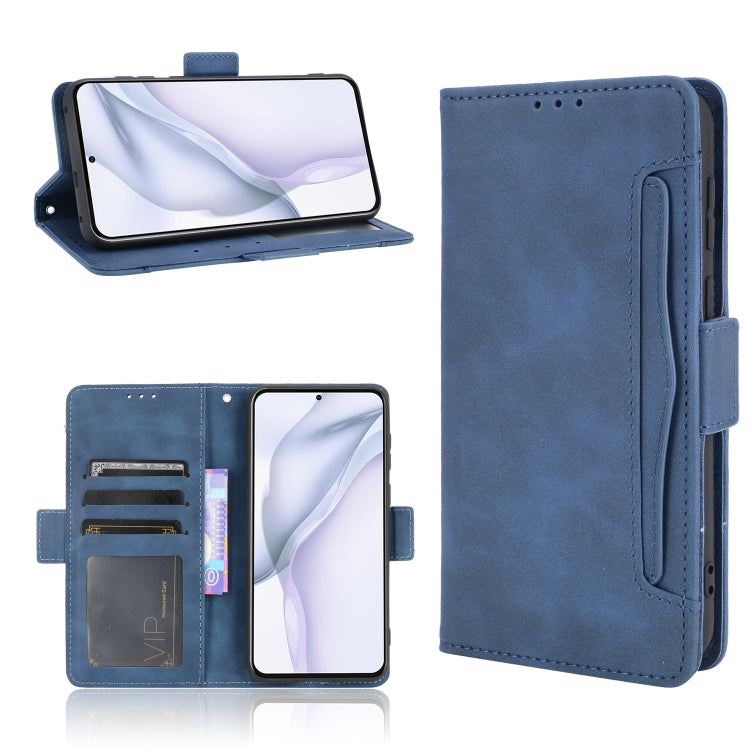 Skin Feel Calf Pattern Horizontal Flip Leather Case with Holder & Card Slots & Photo Frame — view 37