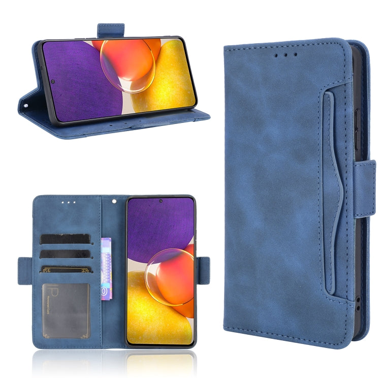 Skin Feel Calf Pattern Horizontal Flip Leather Case with Holder & Card Slots & Photo Frame