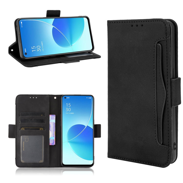 Skin Feel Calf Pattern Horizontal Flip Leather Case with Holder & Card Slots & Photo Frame