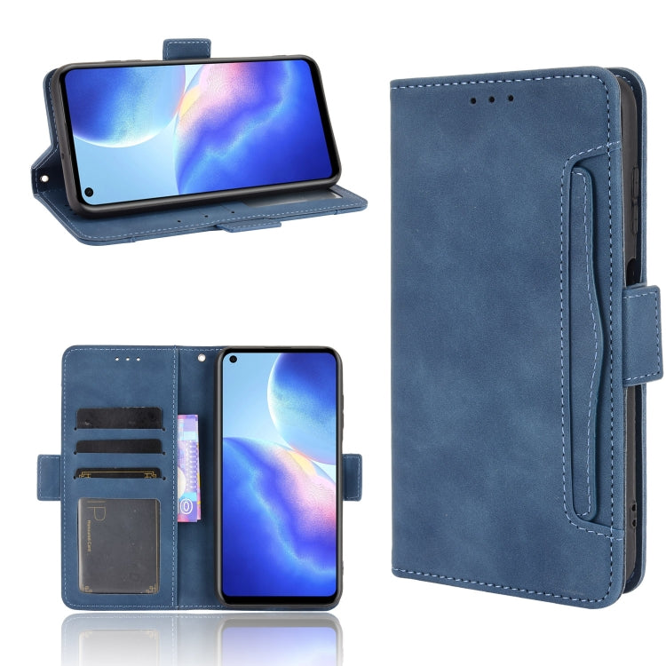 Skin Feel Calf Pattern Horizontal Flip Leather Case with Holder & Card Slots & Photo Frame