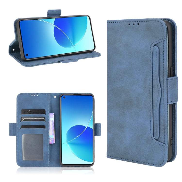 Skin Feel Calf Pattern Horizontal Flip Leather Case with Holder & Card Slots & Photo Frame