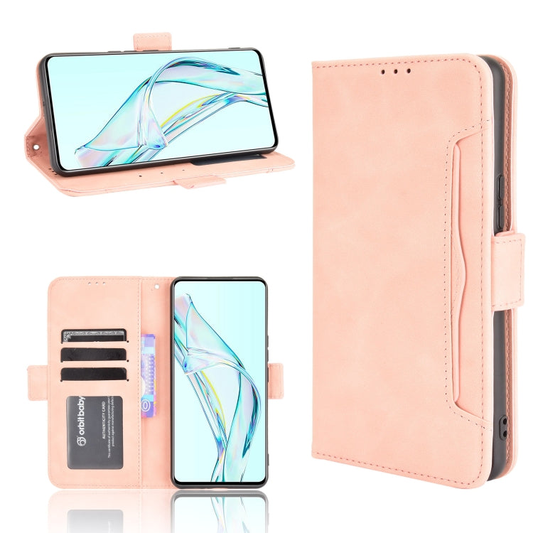 Skin Feel Calf Pattern Horizontal Flip Leather Case with Holder & Card Slots & Photo Frame