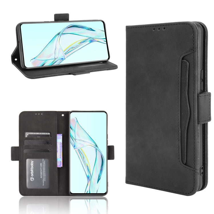 Skin Feel Calf Pattern Horizontal Flip Leather Case with Holder & Card Slots & Photo Frame