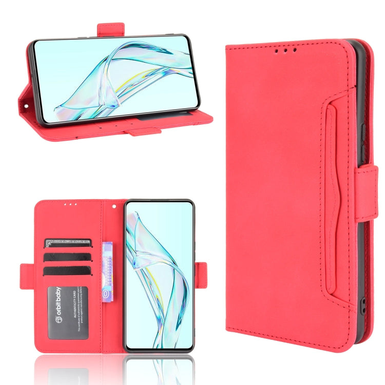 Skin Feel Calf Pattern Horizontal Flip Leather Case with Holder & Card Slots & Photo Frame