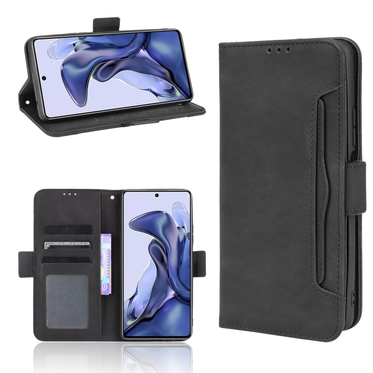Skin Feel Calf Pattern Horizontal Flip Leather Case with Holder & Card Slots & Photo Frame