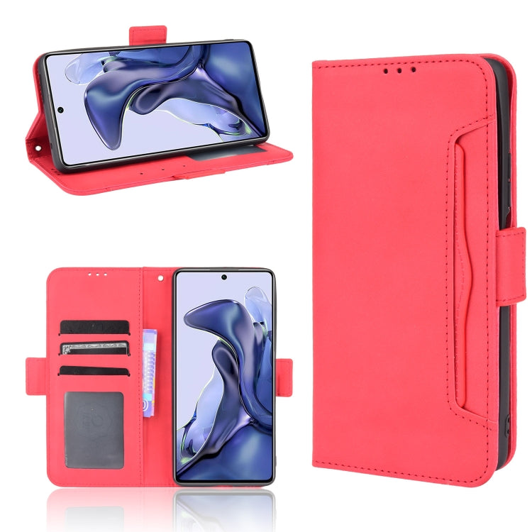 Skin Feel Calf Pattern Horizontal Flip Leather Case with Holder & Card Slots & Photo Frame