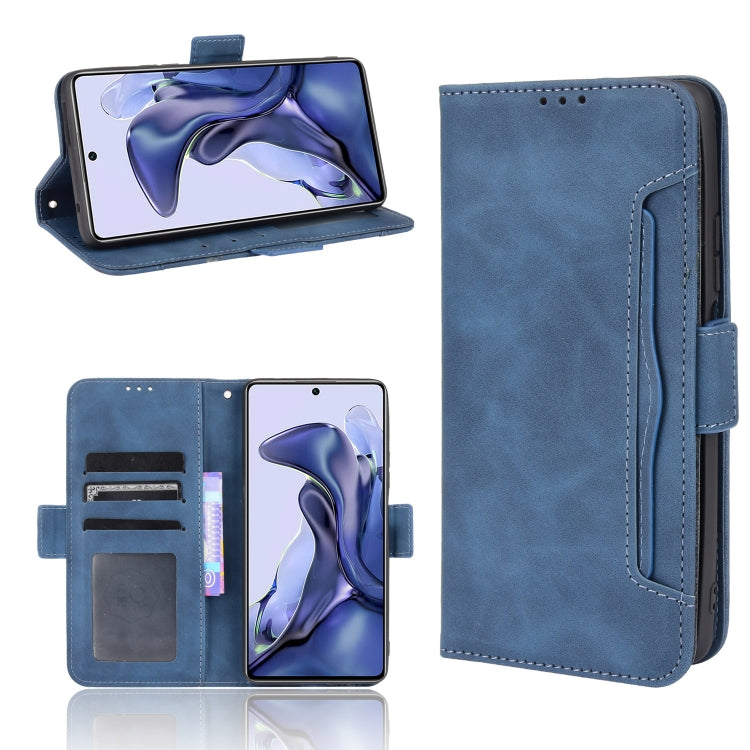 Skin Feel Calf Pattern Horizontal Flip Leather Case with Holder & Card Slots & Photo Frame