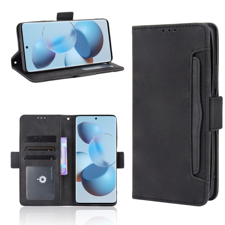 Skin Feel Calf Pattern Horizontal Flip Leather Case with Holder & Card Slots & Photo Frame