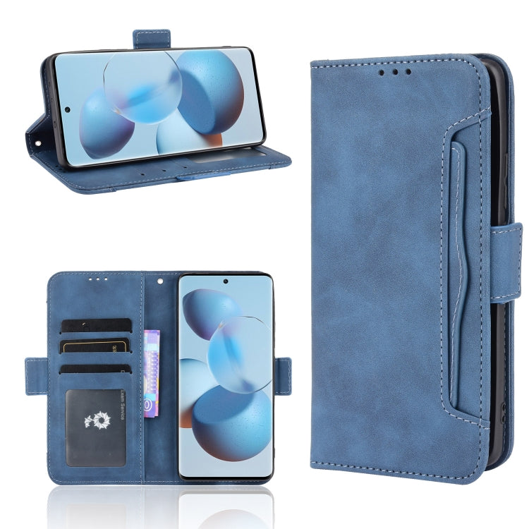 Skin Feel Calf Pattern Horizontal Flip Leather Case with Holder & Card Slots & Photo Frame