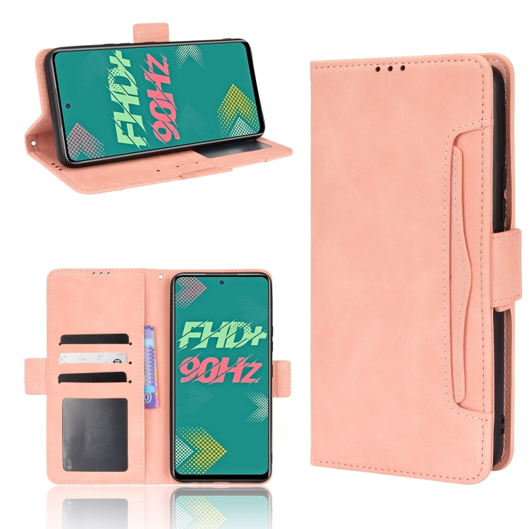 Skin Feel Calf Pattern Leather Phone Case