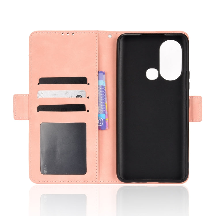 Skin Feel Calf Pattern Leather Phone Case