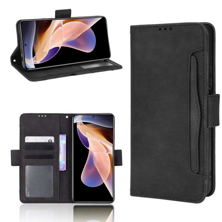 Skin Feel Calf Pattern Leather Phone Case