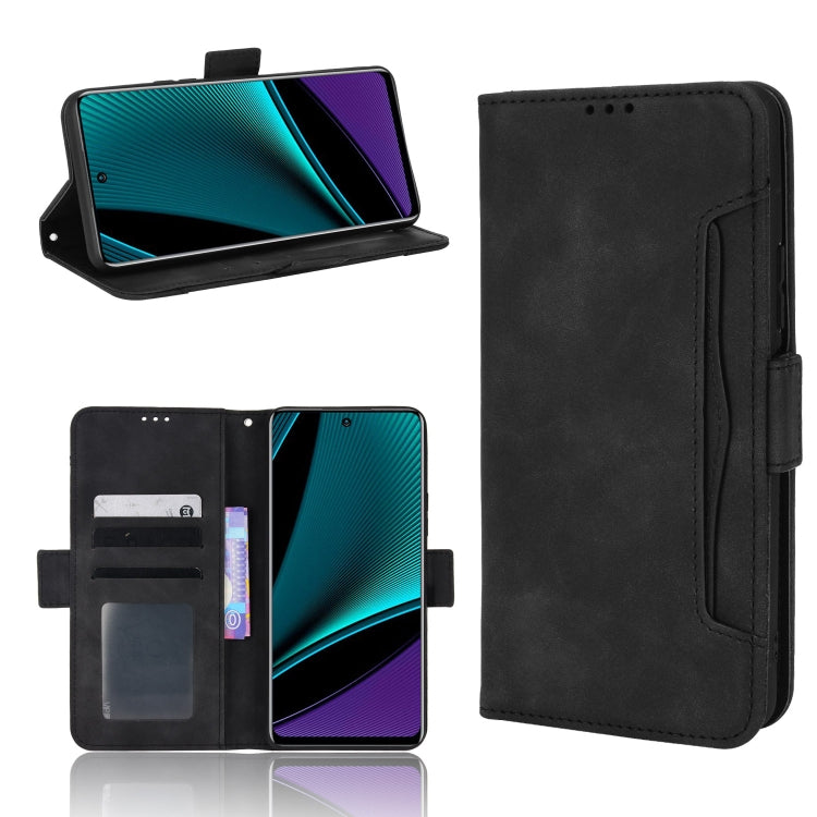 Skin Feel Calf Pattern Leather Phone Case