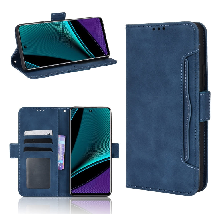 Skin Feel Calf Pattern Leather Phone Case