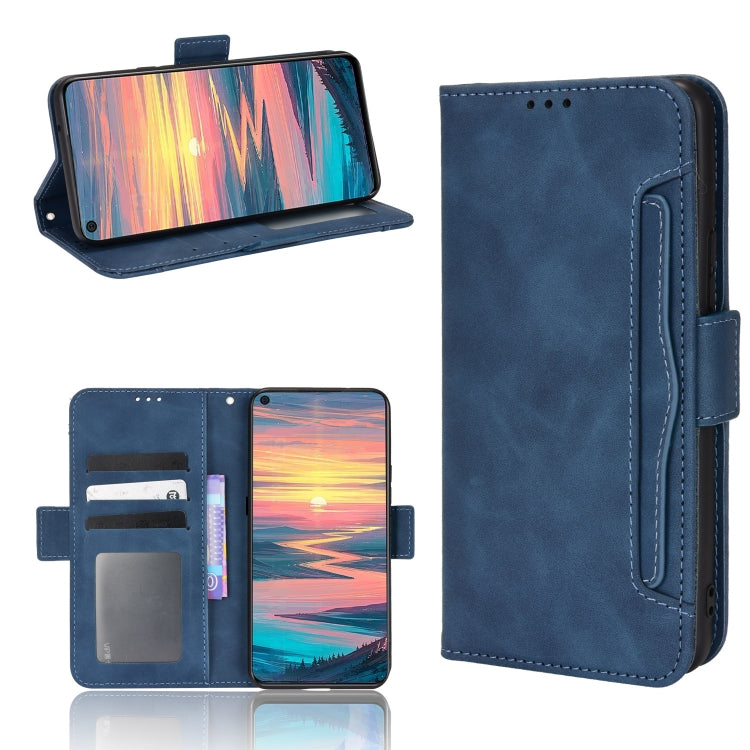 Skin Feel Calf Pattern Leather Phone Case