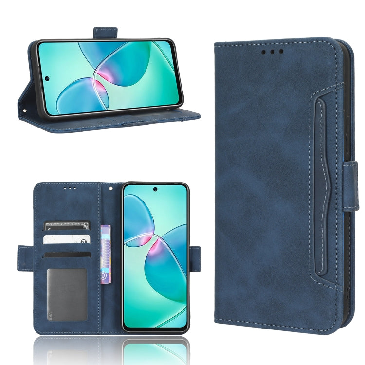 Skin Feel Calf Texture Card Slots Leather Phone Case — view 23
