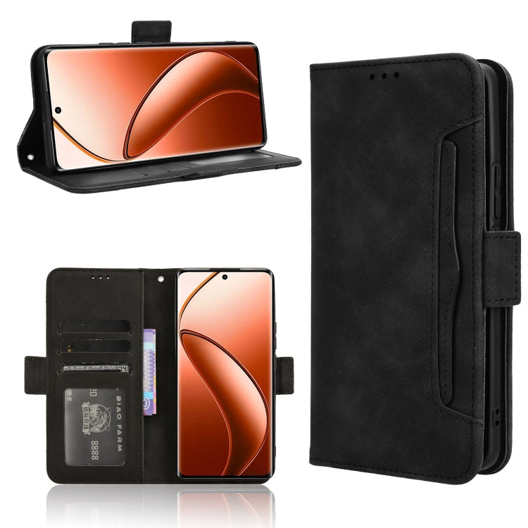 Skin Feel Calf Texture Card Slots Leather Phone Case — For Realme 11 Pro / 11 Pro+