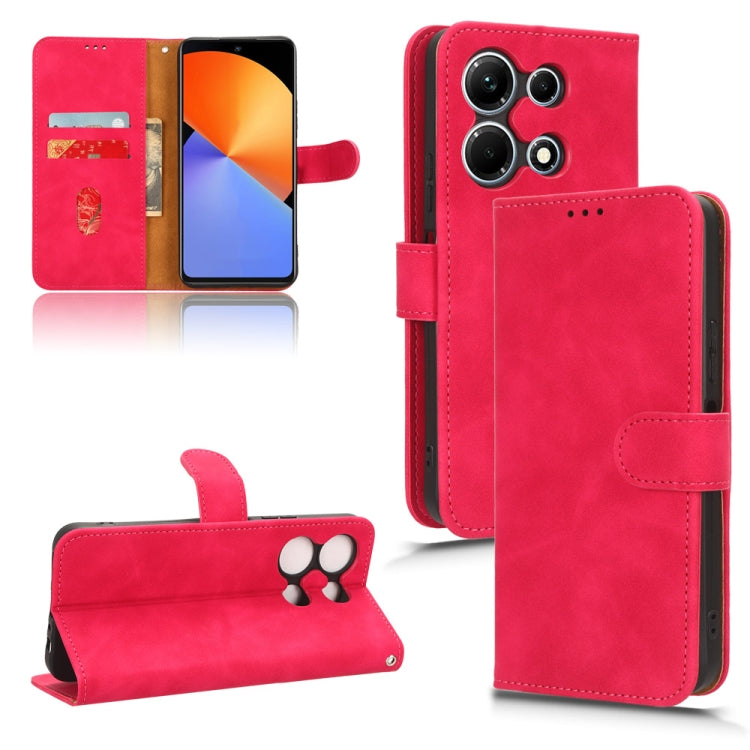 Skin Feel Magnetic Flip Leather Phone Case — view 28