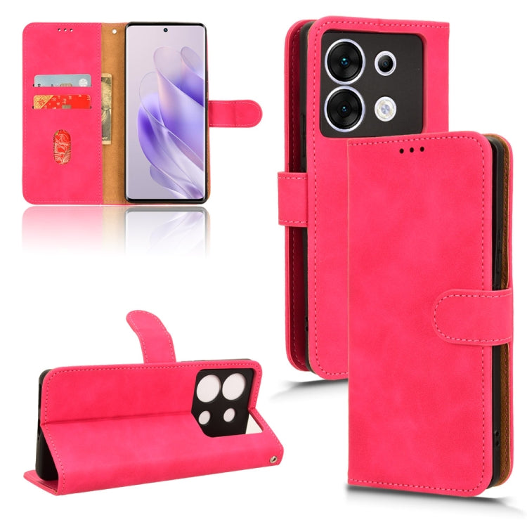 Skin Feel Magnetic Flip Leather Phone Case — view 63