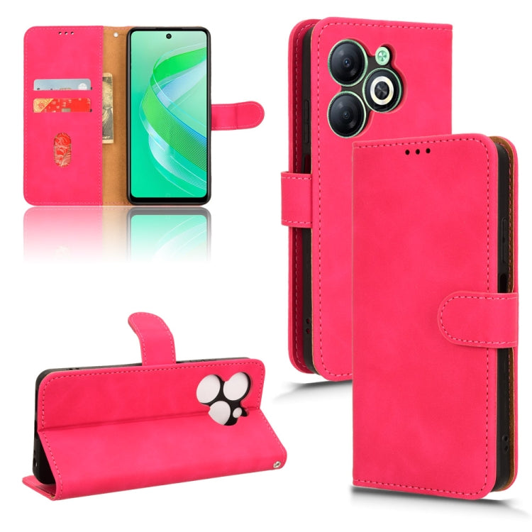 Skin Feel Magnetic Flip Leather Phone Case — view 58