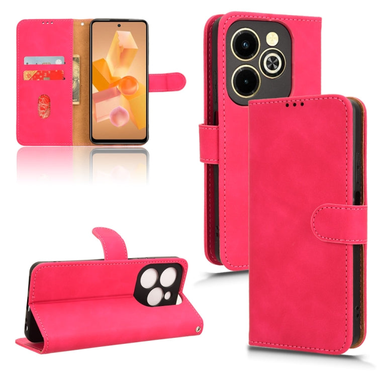 Skin Feel Magnetic Flip Leather Phone Case — view 53
