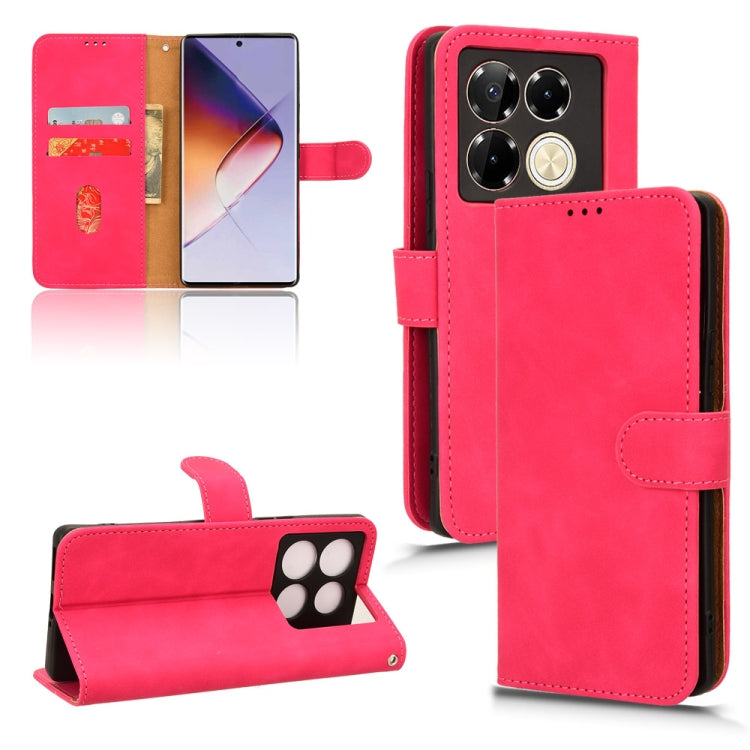 Skin Feel Magnetic Flip Leather Phone Case — view 48