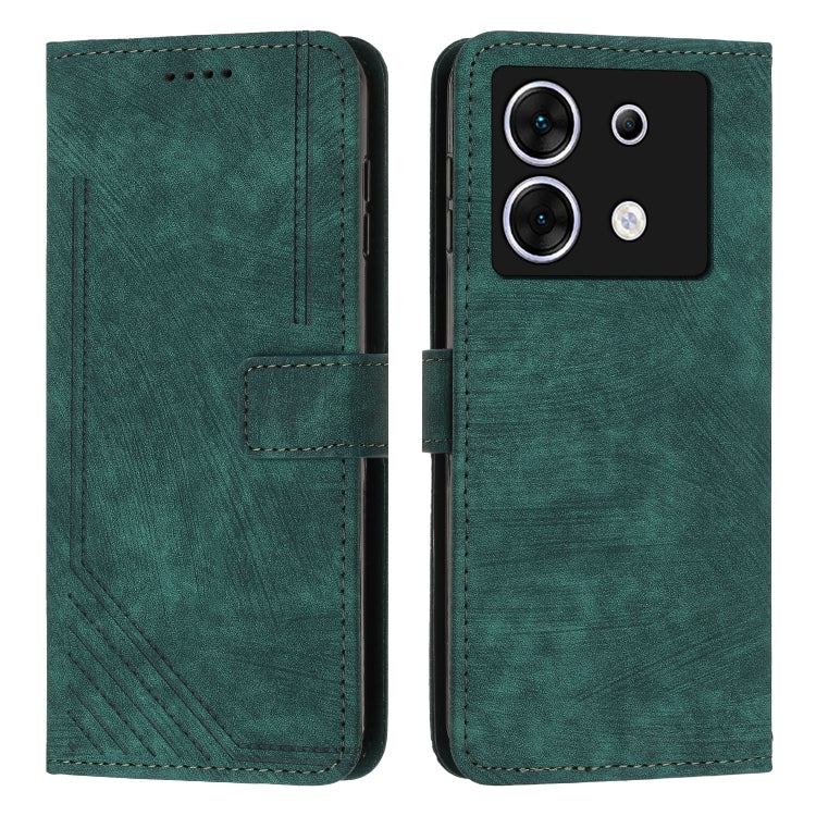 Skin Feel Stripe Pattern Leather Phone Case with Lanyard — view 45