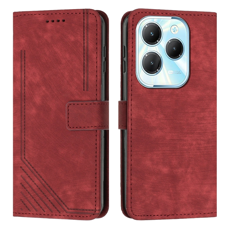 Skin Feel Stripe Pattern Leather Phone Case with Lanyard — view 20