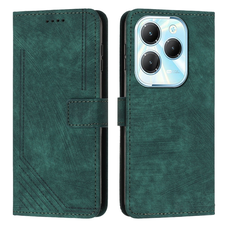 Skin Feel Stripe Pattern Leather Phone Case with Lanyard — view 21