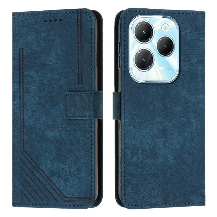 Skin Feel Stripe Pattern Leather Phone Case with Lanyard — view 22