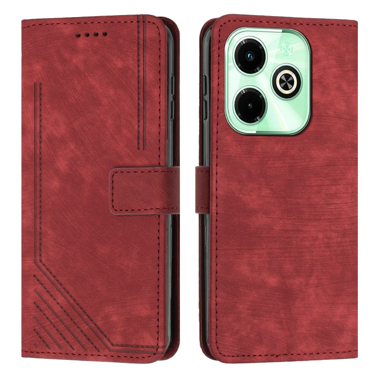 Skin Feel Stripe Pattern Leather Phone Case with Lanyard — view 26