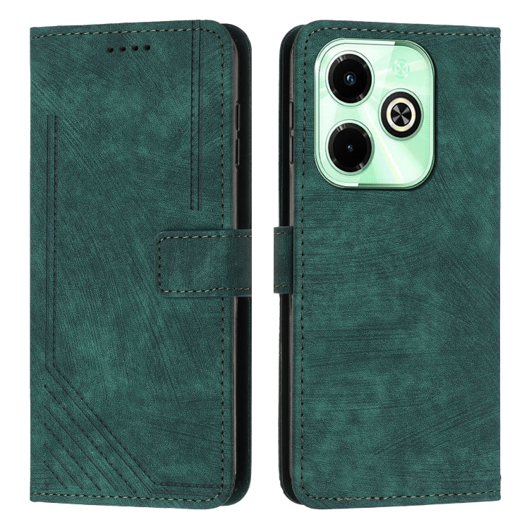 Skin Feel Stripe Pattern Leather Phone Case with Lanyard — view 27