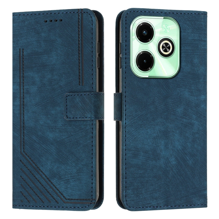 Skin Feel Stripe Pattern Leather Phone Case with Lanyard — view 28