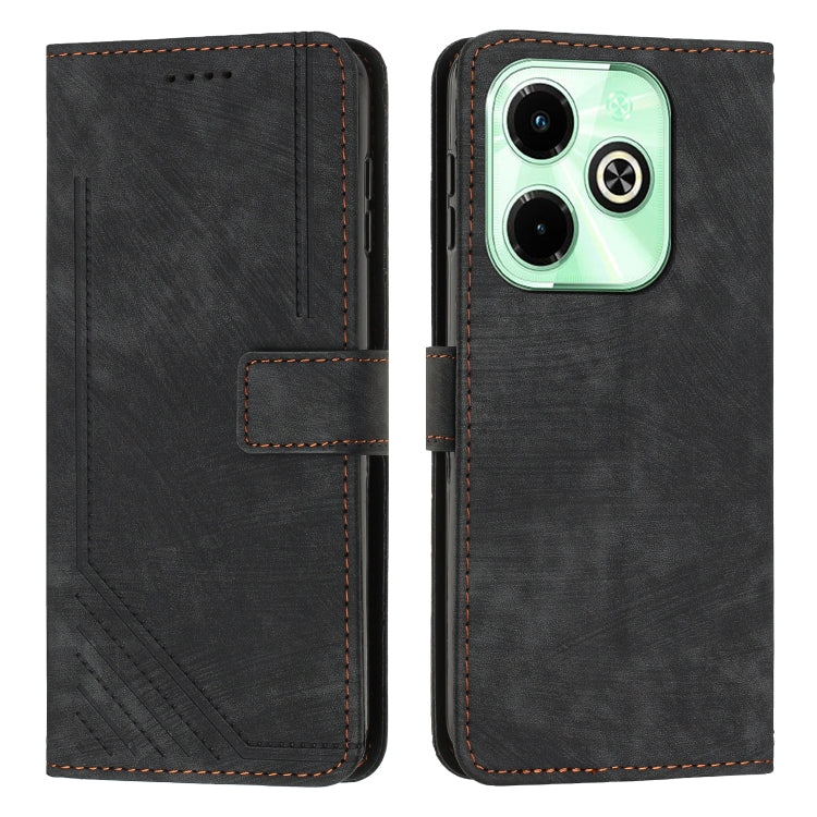 Skin Feel Stripe Pattern Leather Phone Case with Lanyard — view 29