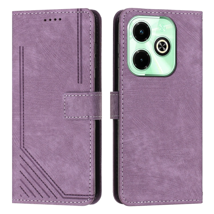 Skin Feel Stripe Pattern Leather Phone Case with Lanyard — view 30