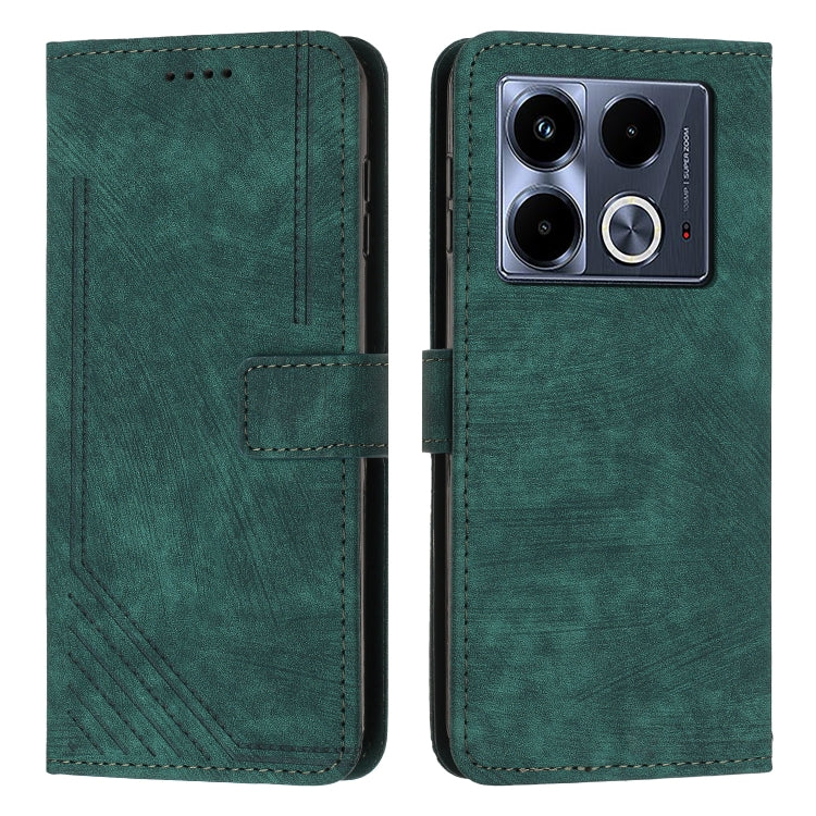 Skin Feel Stripe Pattern Leather Phone Case with Lanyard — view 57