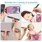 W1 Smart WiFi Ear Pick Cleaning Kit Ear Wax Removal Tool with LED Light — view 7