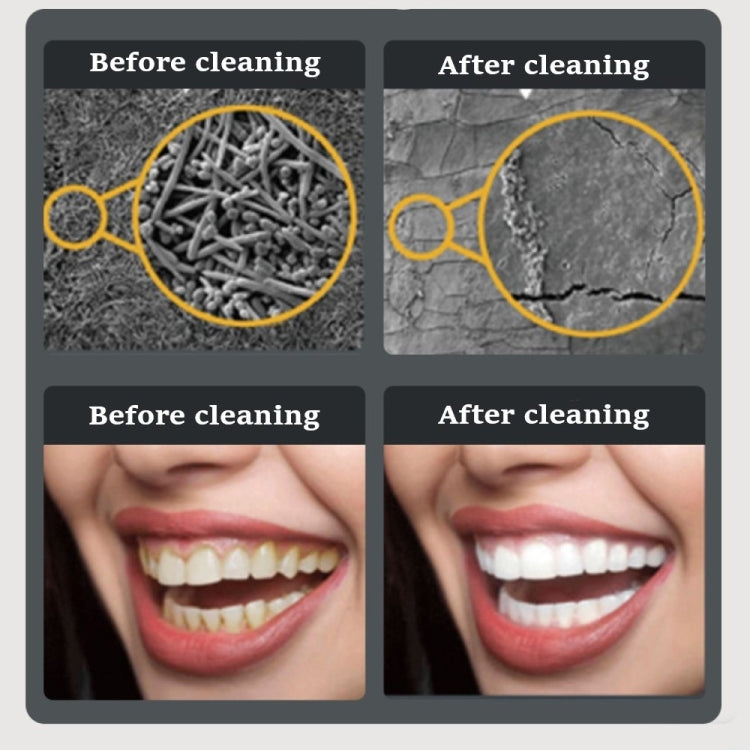 Ultrasonic Electric Dental Scaler Teeth Plaque Cleaner Dental Stone Removal With LED Light