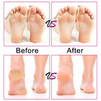 Electric Foot File Speed Adjustable Sandpaper Discs Callus Remover Pedicure Fast Remove Feet Hard Cracked Dry Dead Skin Tool
